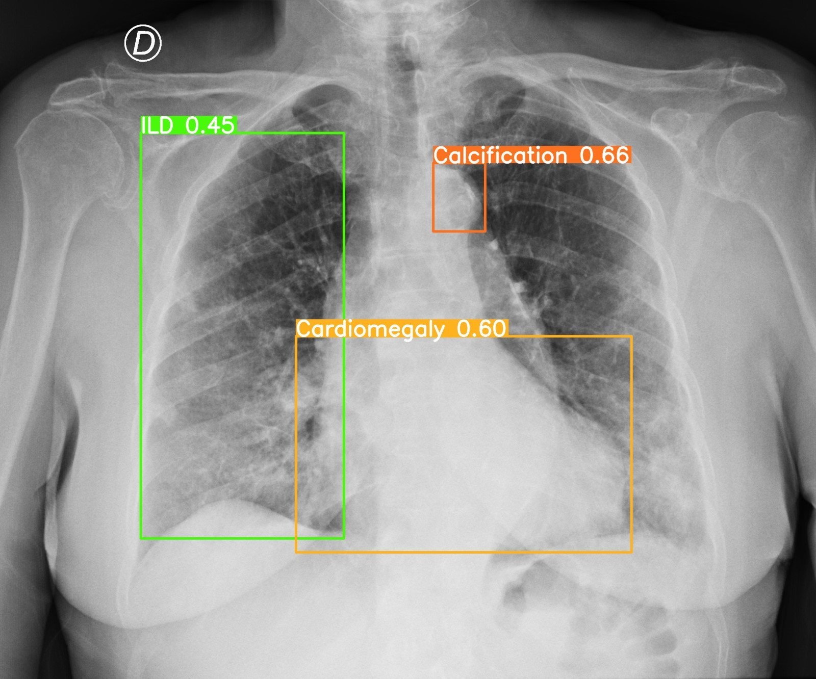 Neural Labs xray photo